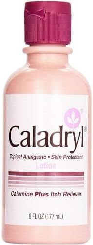 Caladryl Calamine Lotion for Itching, Insect Bites & Poison Ivy, 6 Fl Oz