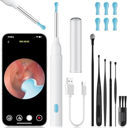 Ear Wax Removal Tool with Camera - 1296P HD Ear Cleaner Otoscope with 6 LED Lights, Wireless Earwax Remover Kit with 8 Pcs Ear Picks, WiFi Ear Scope Cleaning Kit for iPhone (Cream Milky)